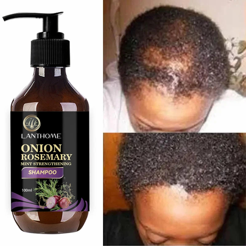 Kit Capilar Crescimento Rápido – Shampoo de Alecrim e Cebola 100ml + Spray Antiqueda 30ml | Resultados em 7 Dias
